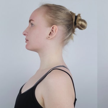 Total body alignment result